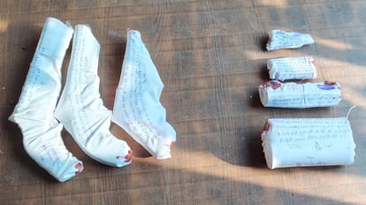 Sambhal: young man story is suspicious, SP said, type of bullet that hit him is not used by police