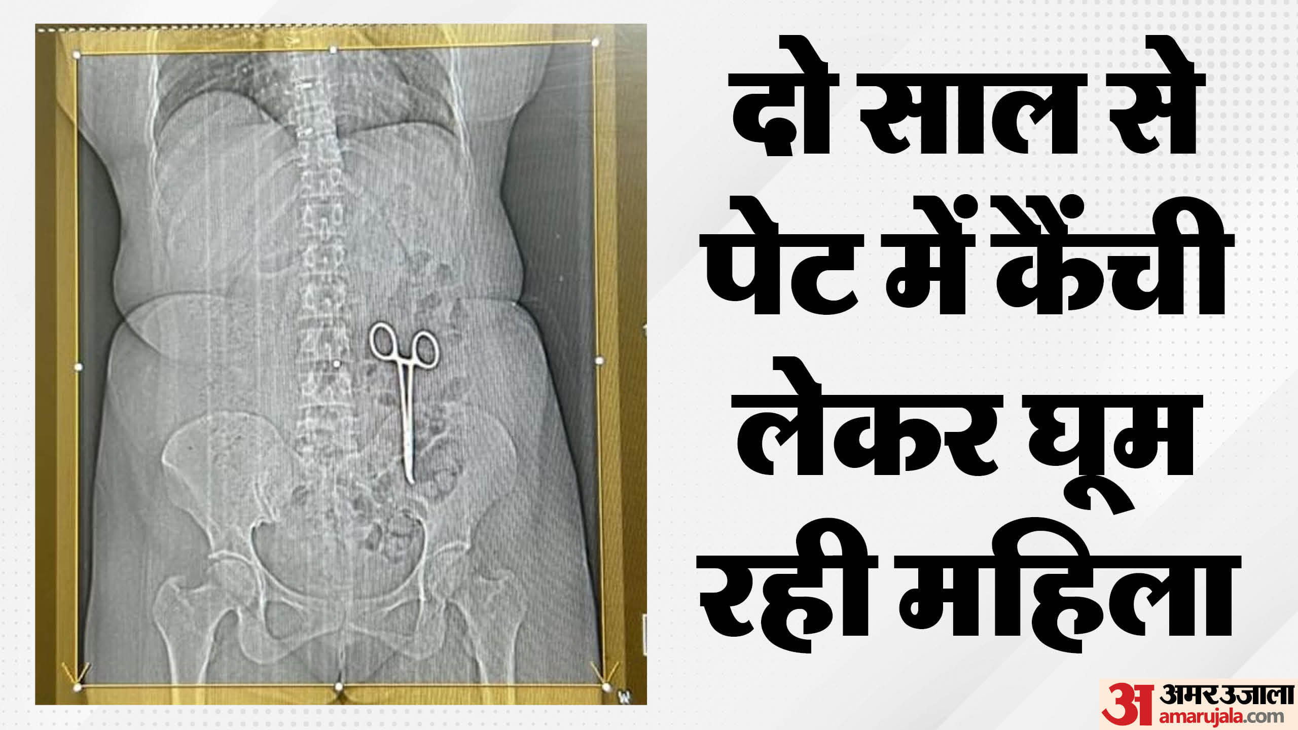 पेट में कैंची।