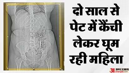 MP News: महिला के पेट में कैंची, इसके कारण दो साल से हो रहा था दर्द, कैसे पहुंची यह जानकर हो जाएंगे हैरान MP Bhind News: Scissors in woman's stomach suffering from pain for two years
