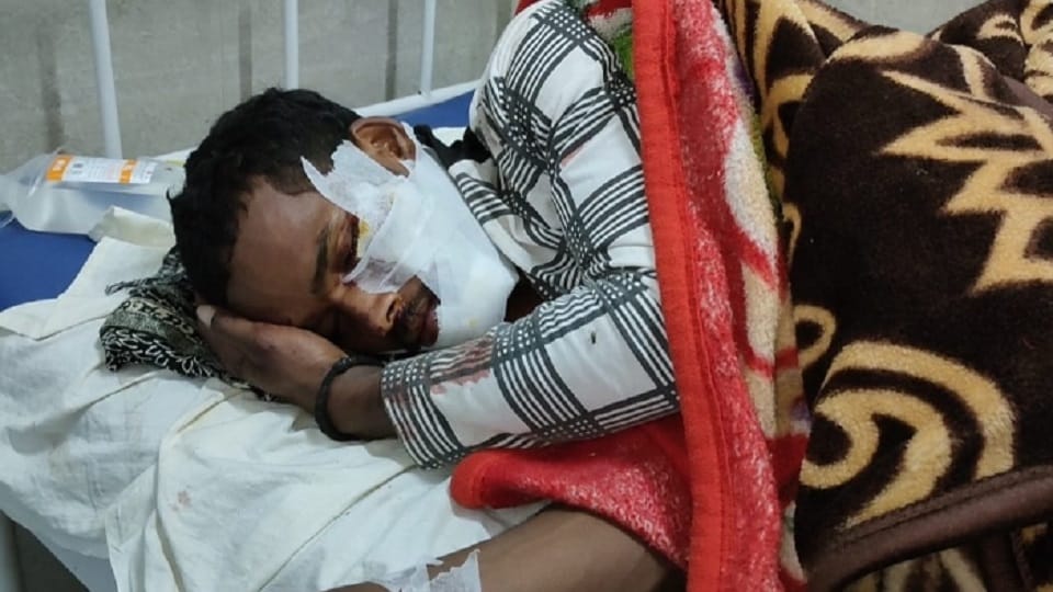 Gaurela Pendra Marwahi: Auto full of people overturned, a Baiga woman died on the spot; two injured