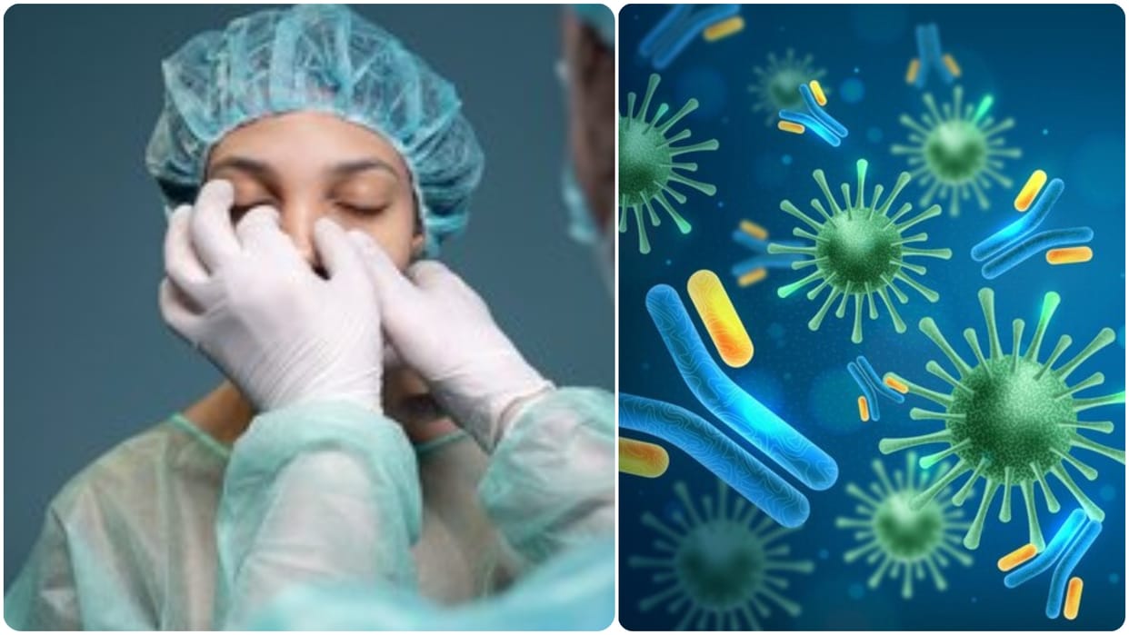 outbreak of Marburg virus disease know what is Bleeding eye disease and its health risk in hindi