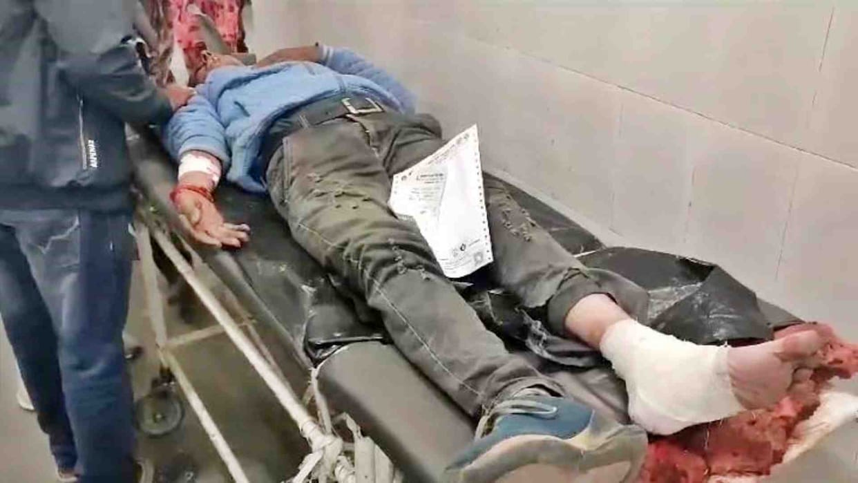 Alwar News: Two children including the driver injured after school e-rickshaw overturned