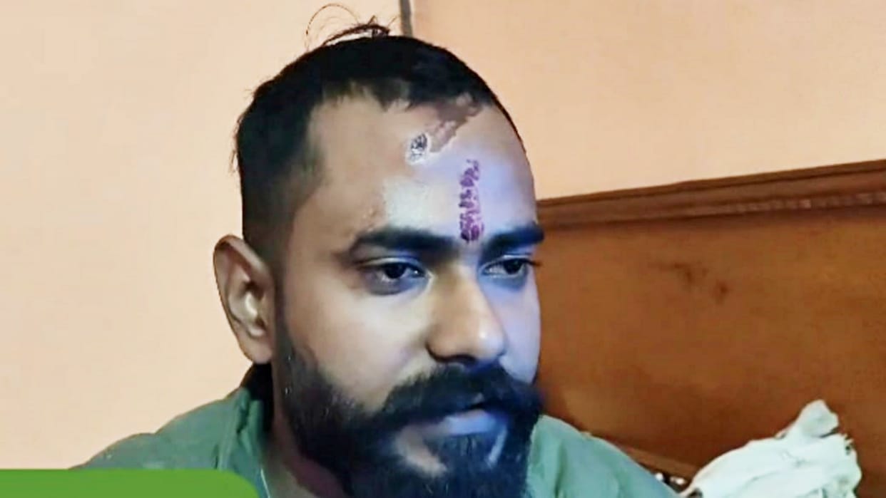 Bettiah News: Lawrence Bishnoi gang member Shashank Pandey claims murderous attack, police dismisses case