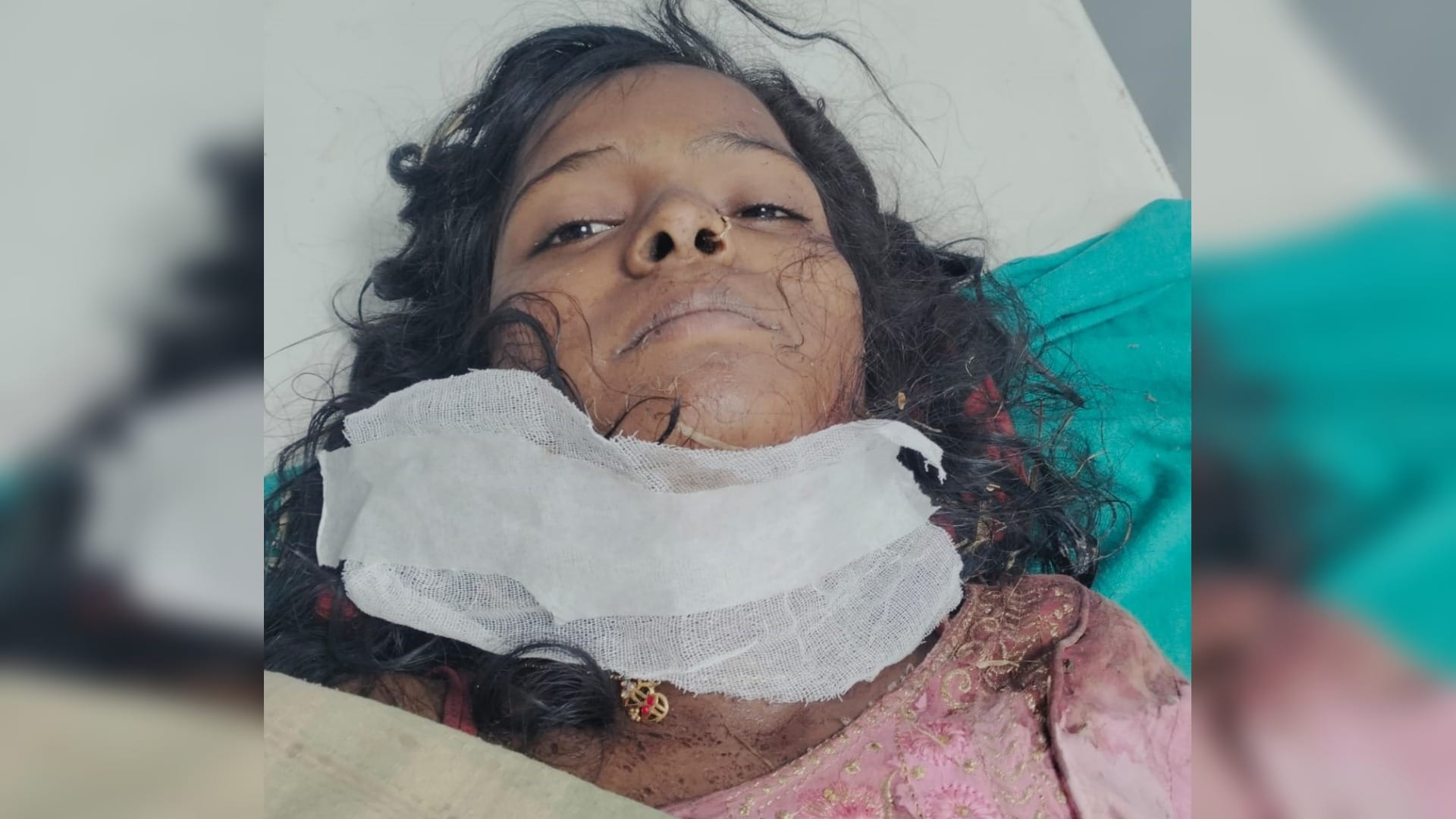 अस्पताल में भर्ती घायल युवती