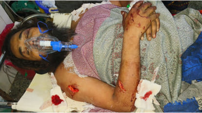 In Gorakhpur, Fighting and stabbing over dispute over playing cricket, scuffle with police too