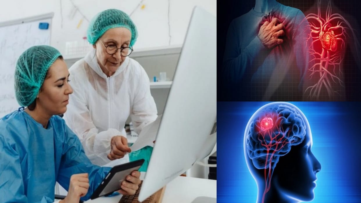 Stroke Cases increasing approx. 50 lacs death per annum middle and lower income nations