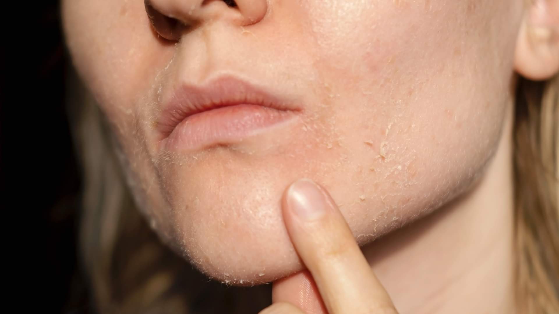 Beauty Tips in Hindi Garm Pani Se Chehra Dhone Ke Nuksan