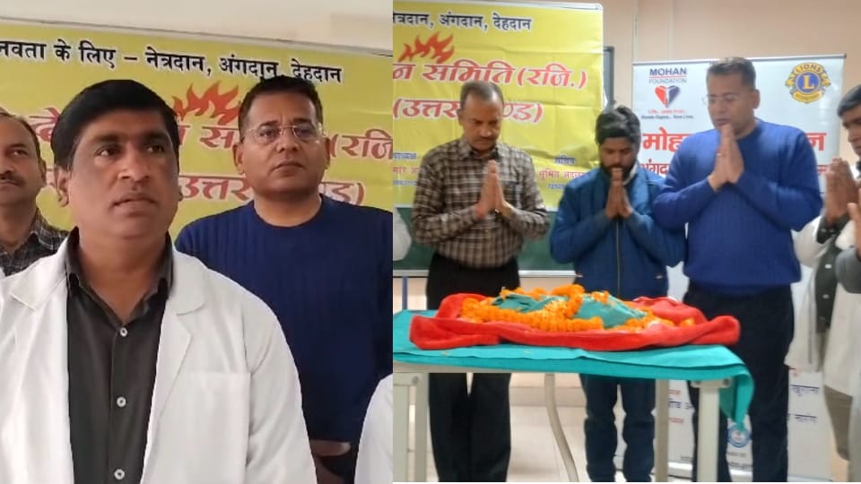 Dehradun News Family donated body of their two and half day old daughter Saraswati will be kept in museum