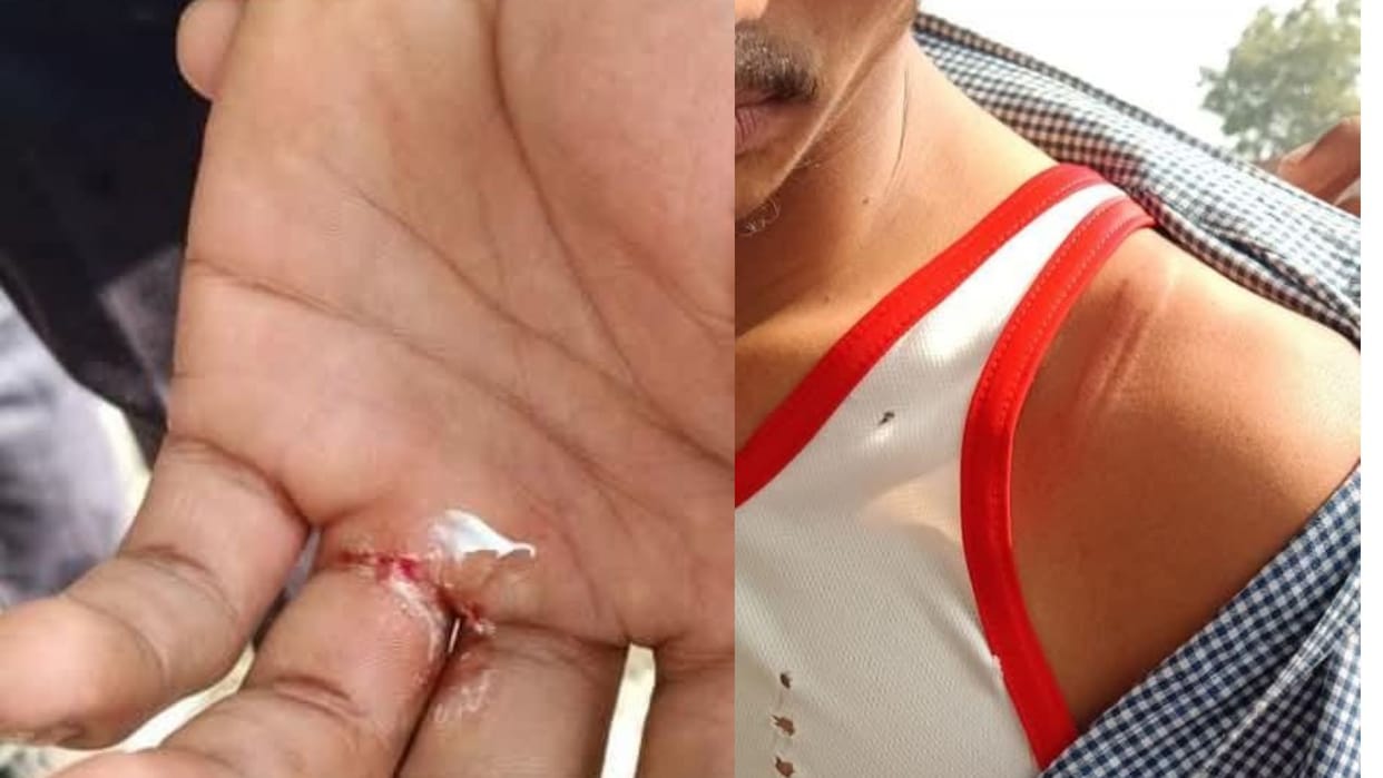 Student said it's my seat fight among themselves college manager accused of beating with sticks