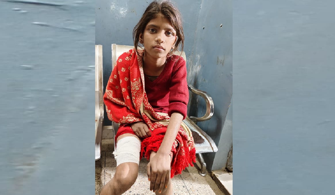 Girl injured in wild boar attack girl was playing outside the house ran away when villagers shouted