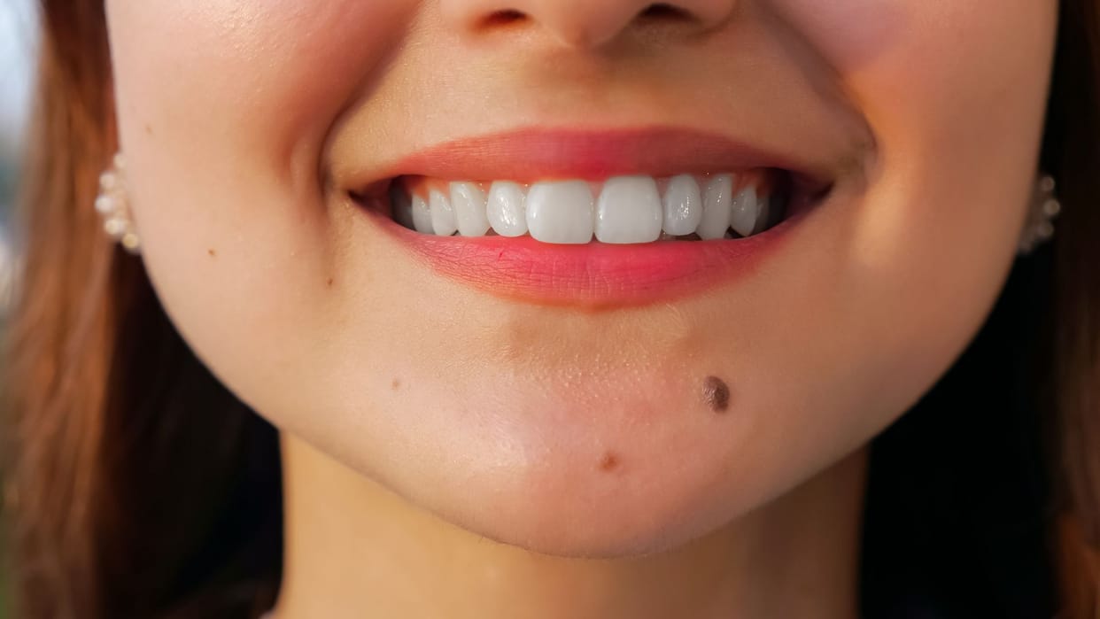 Moles on Different Body Parts and Their Meaning According to Astrology Know Significance