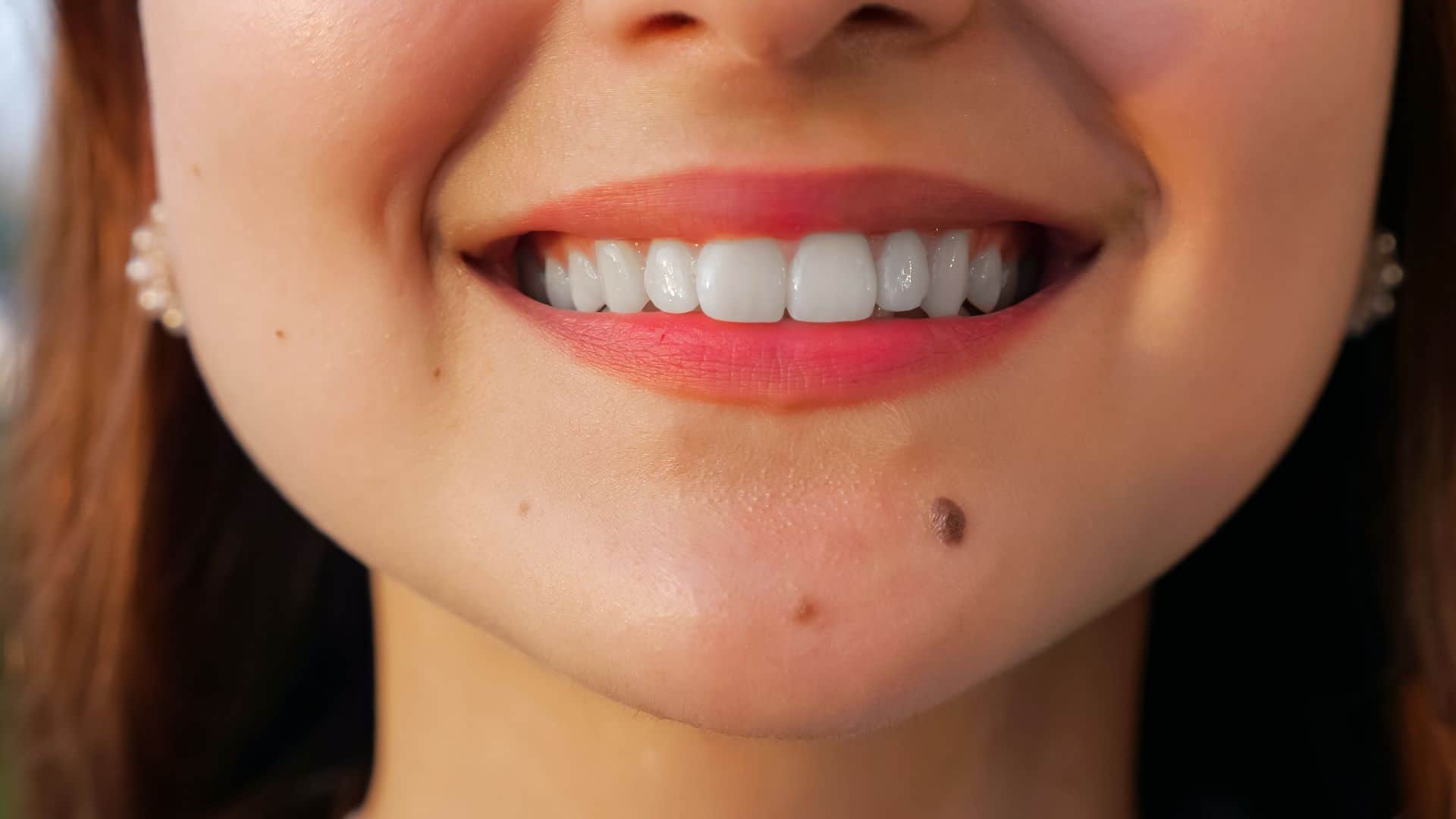 Meaning of moles on different parts of your face know chehre pat til ka matlab