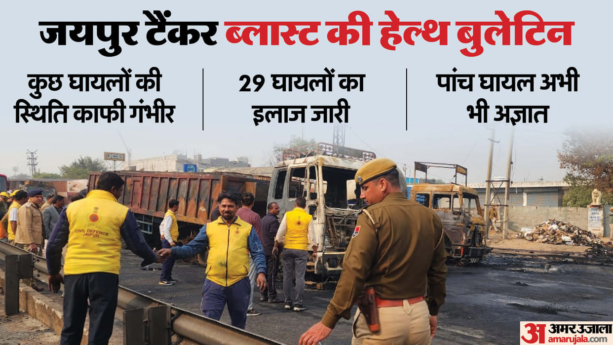 Jaipur Tanker Blast fire damaged windpipe of injured in accident know what doctor said