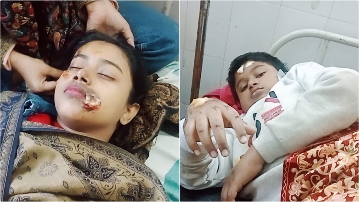 Bihar News: High speed car hits bike in Kishanganj, father and two children seriously injured
