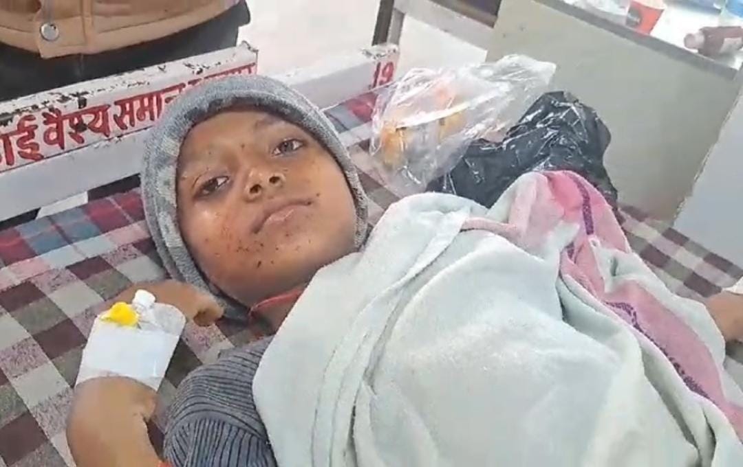Chhatarpur: A firecracker exploded in the hand of a 10-year-old child, he found a bomb on the road while playi