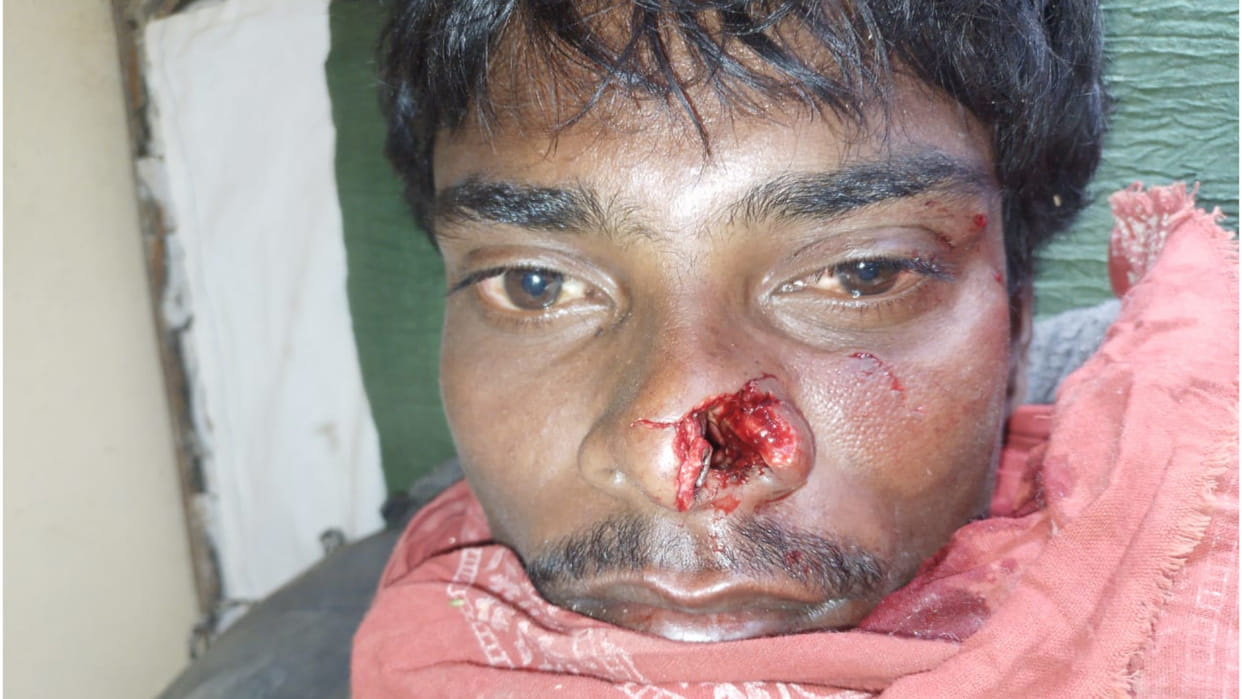 In Gorakhpur, Monkeys rampage in Raghunathpur, young man's nose cut off