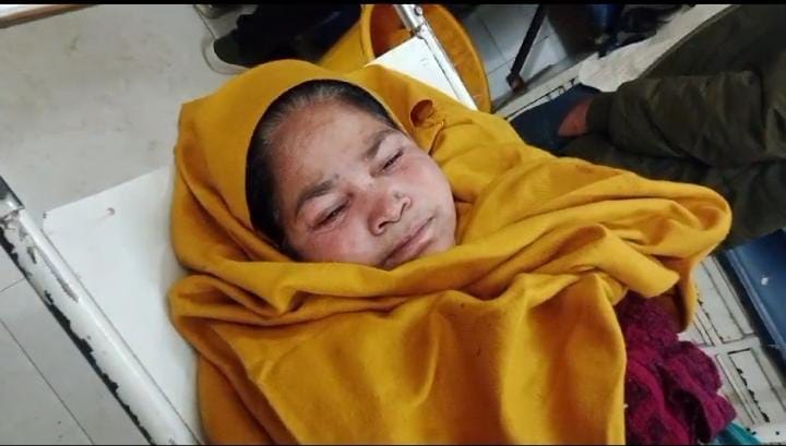 Sitapur: Woman shot by young man, serious trauma referred, police is investigating in the direction of love af