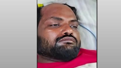 अस्पताल में भर्ती अरशद।