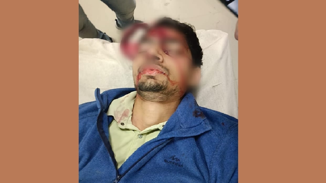 B.P.Ed student shot himself in Rohtak MDU, admitted in critical condition