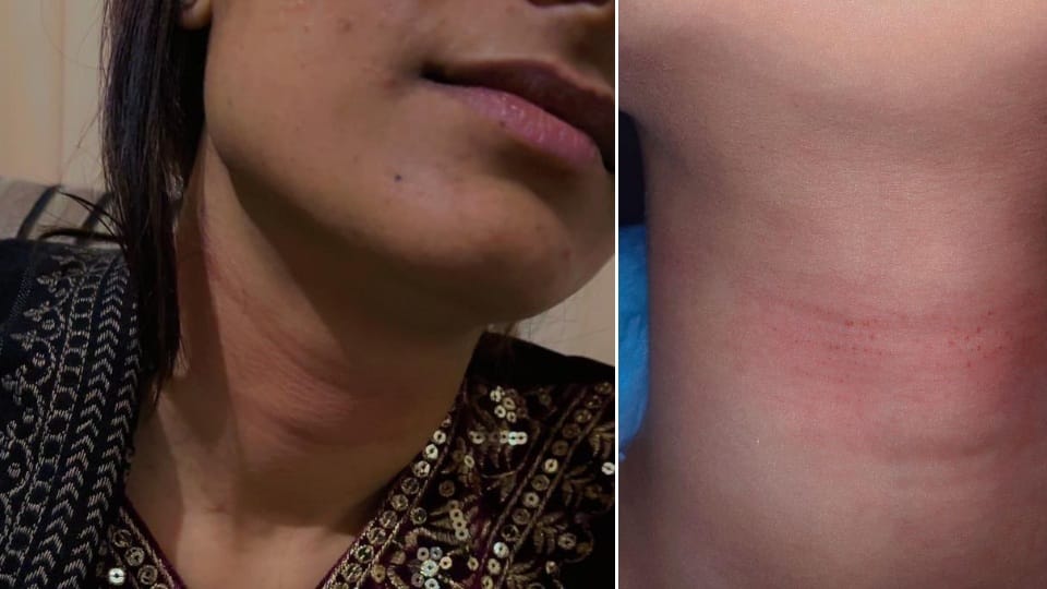 Female teacher assaulted in Halwara police accused of not taking action