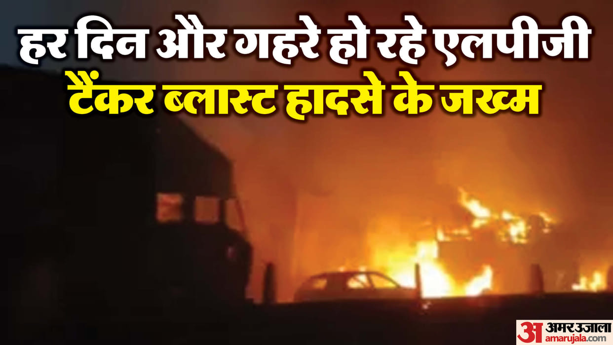 Jaipur Ajmer Highway Gas Tanker Blast Case One More Injured Died Know Death Toll News in Hindi