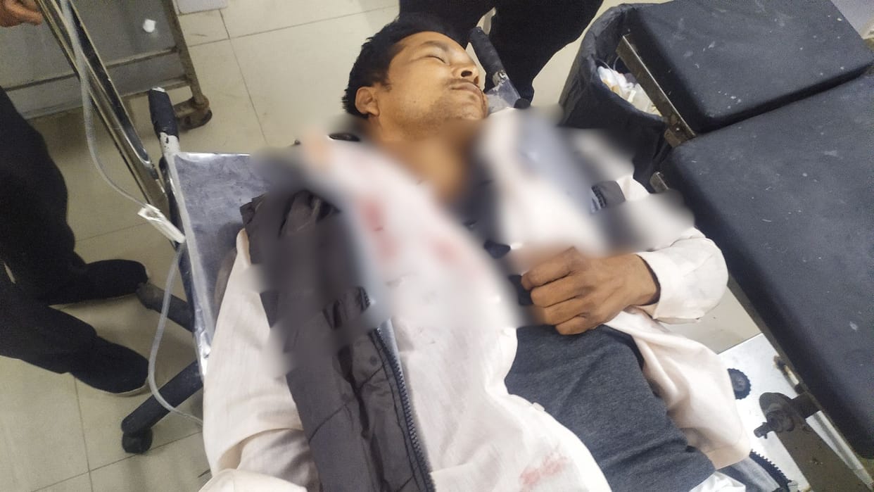 A young man going to the market with his friend was shot three miscreants on a bike committed the crime