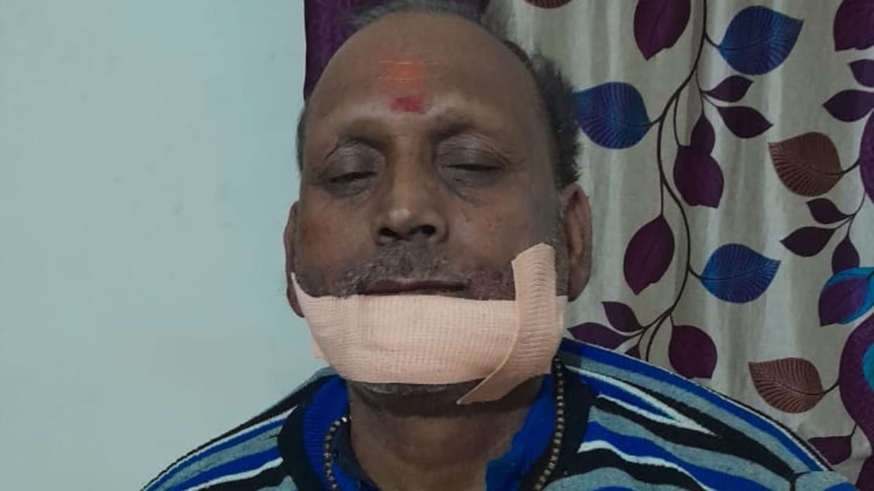 Old man injured by China-made Manjha police running a campaign, two sellers arrested
