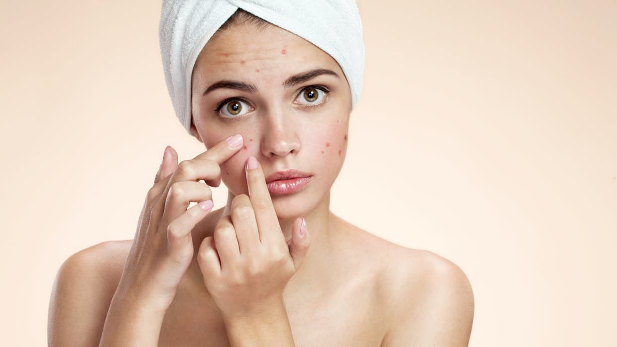 how to remove pimples with home remedy in hindi