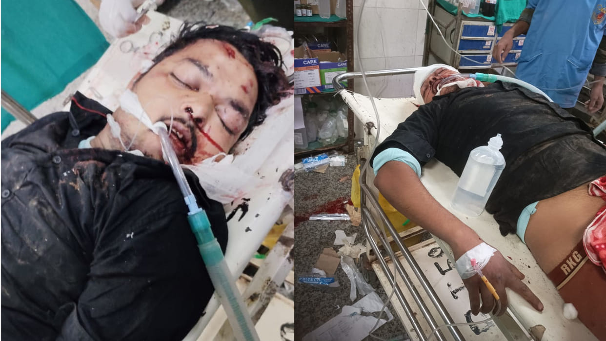 In Gorakhpur,2 parties who had come to attend Brahmabhoj program got into a fight at a liquor shop,injured.