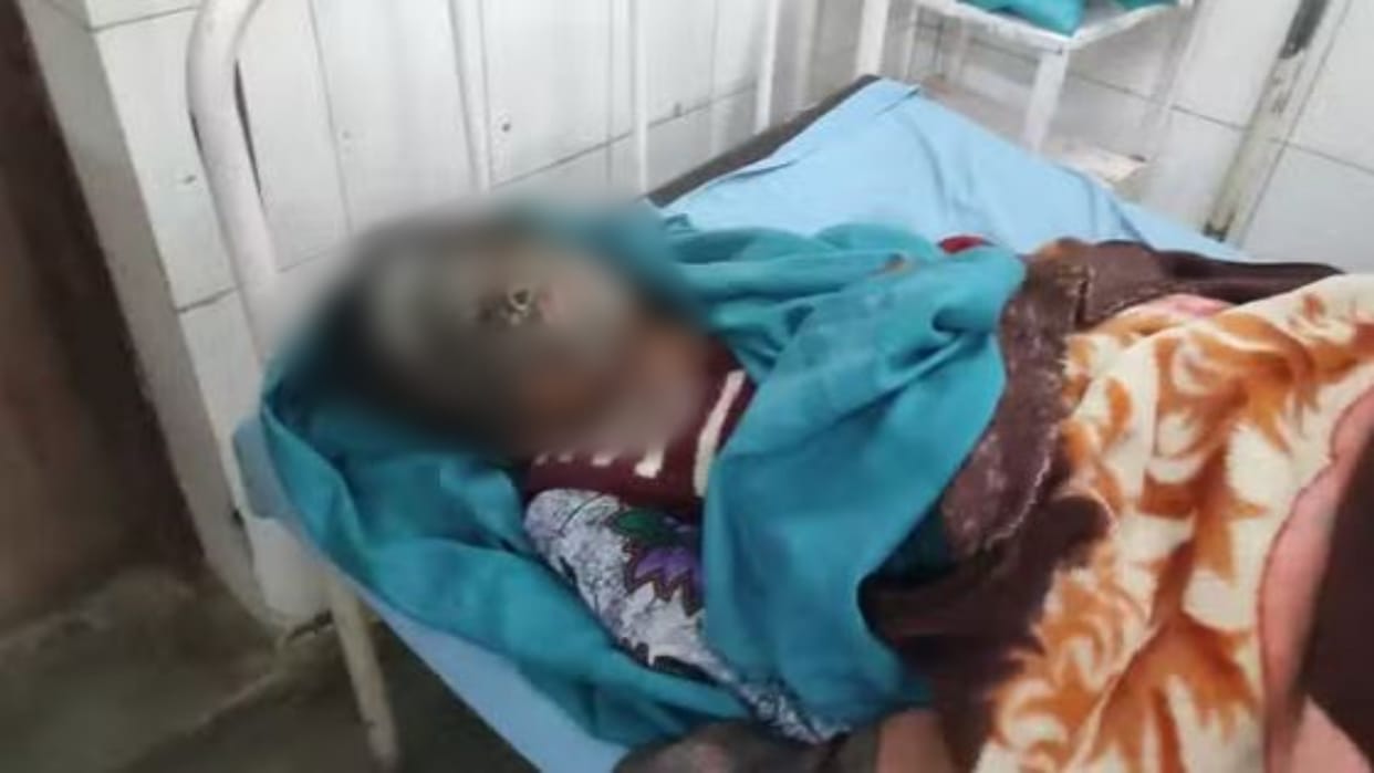 Alwar News Four people got severely burnt at different places including an innocent girl