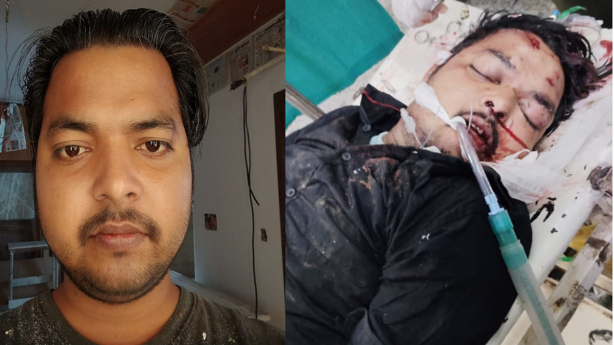 In Gorakhpur, Couldn't find a chair to sit, former BDC hit his head with a brick, died