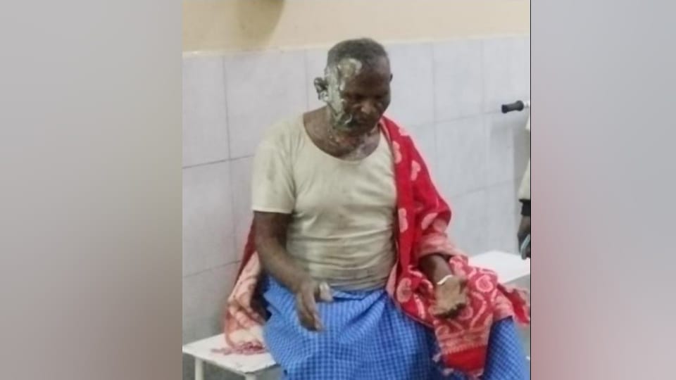 Son set fire his father on pouring petrol also stabbed his mother In Maharajganj