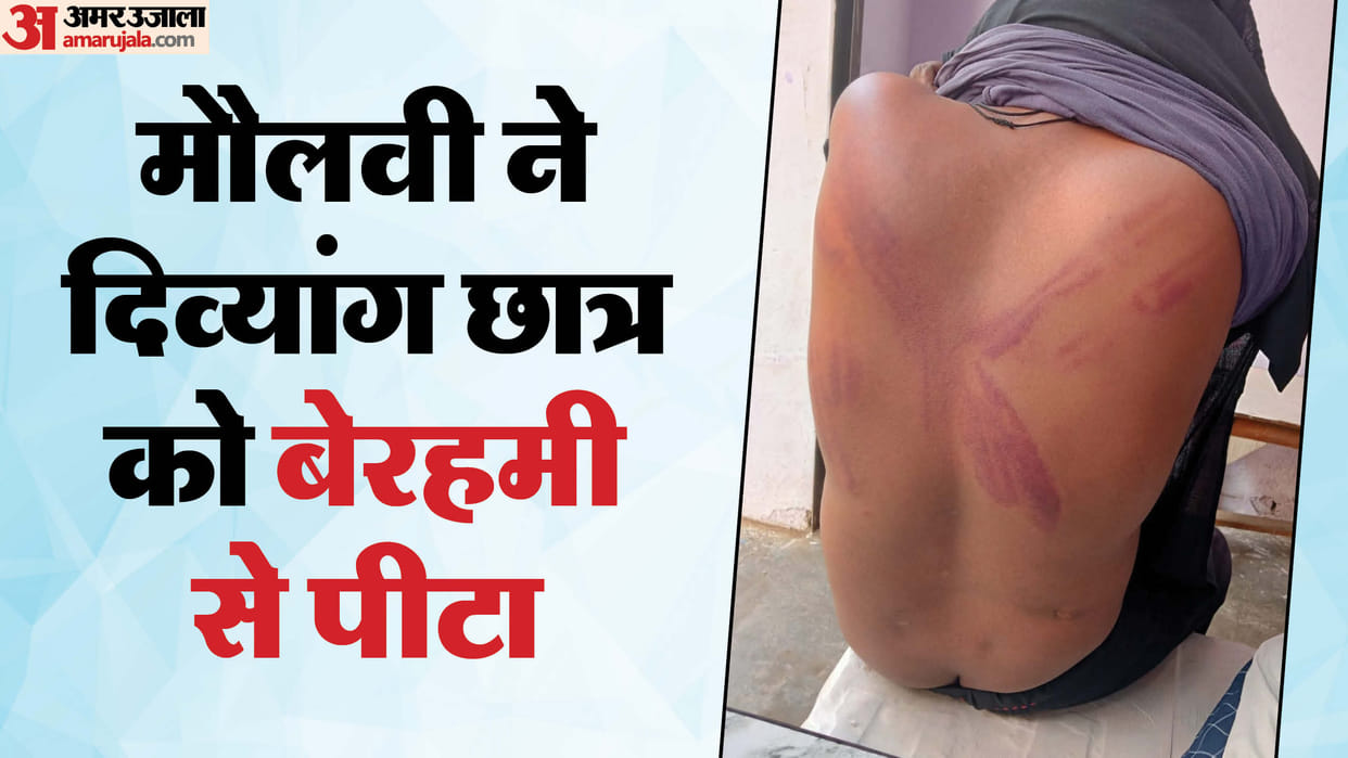 Madrasa teacher beat up a handicapped student who came after four days In Bareilly