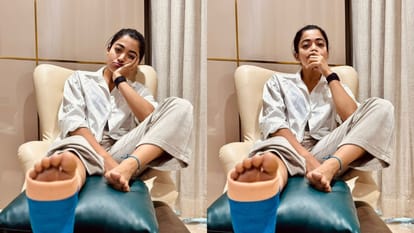 Rashmika Mandanna got injured during gym workout shared photos and told about her condition