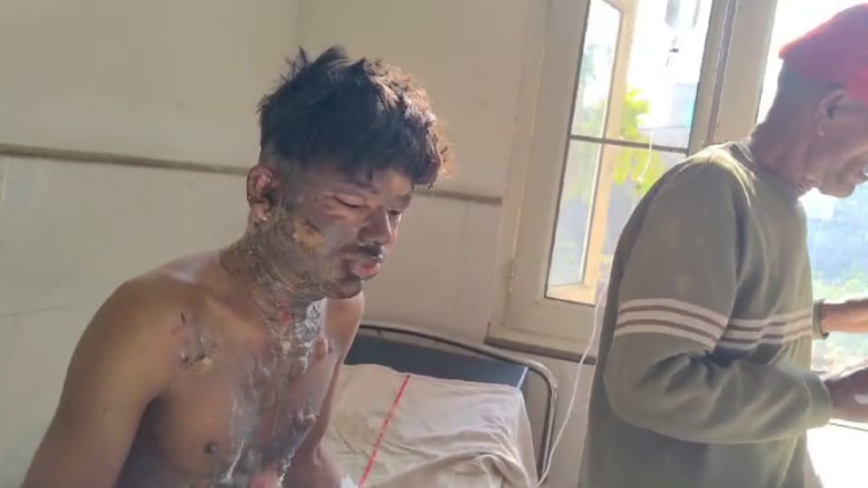Cousin sprinkles petrol on young man and sets him on fire in Panipat