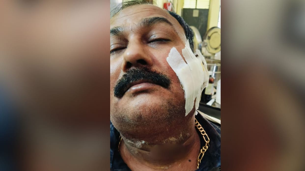 youth attacked village head representative with knife in Ghazipur