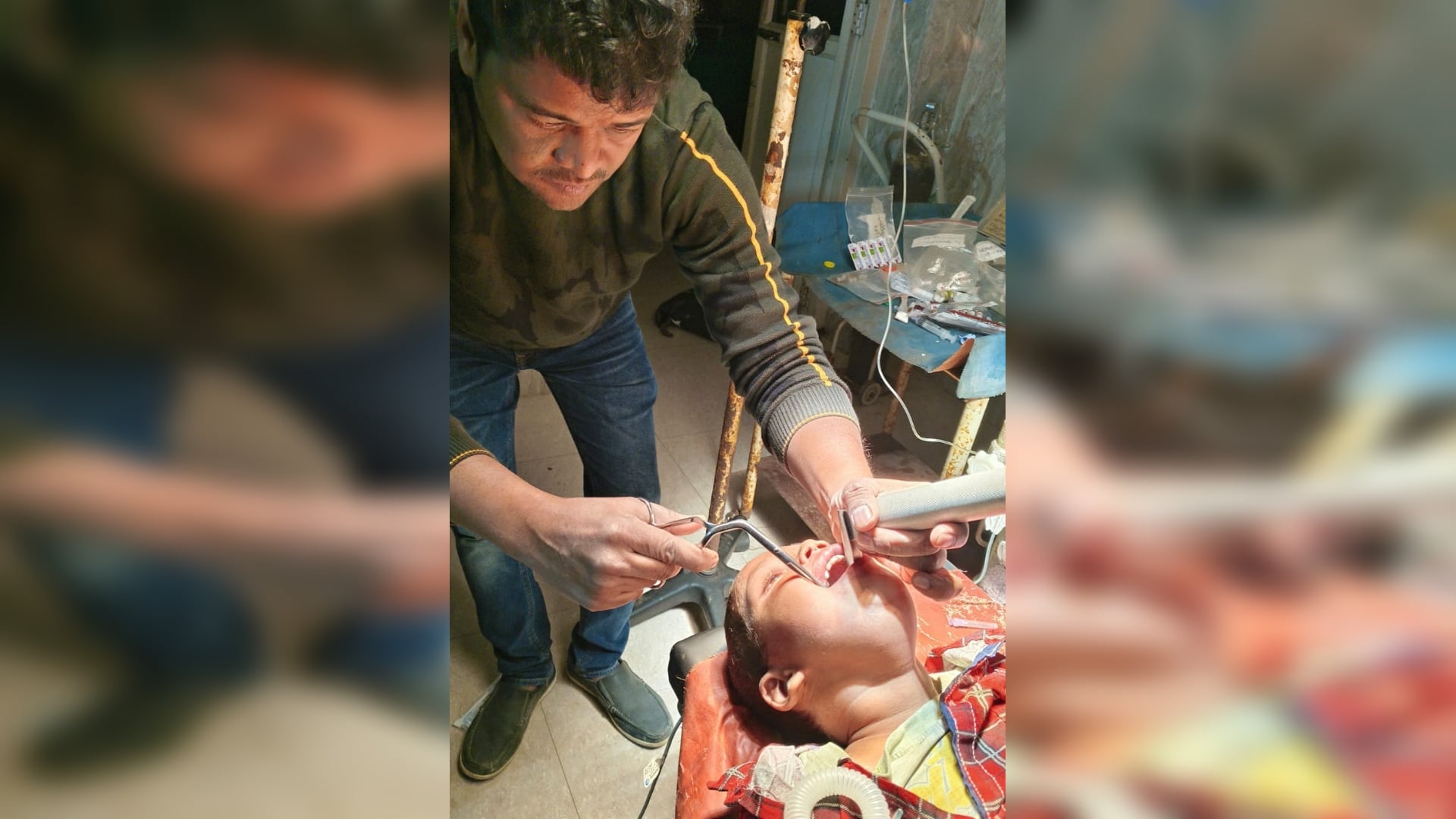Purnea News: GMCH doctor saved life of innocent boy, removed steel gear without operation
