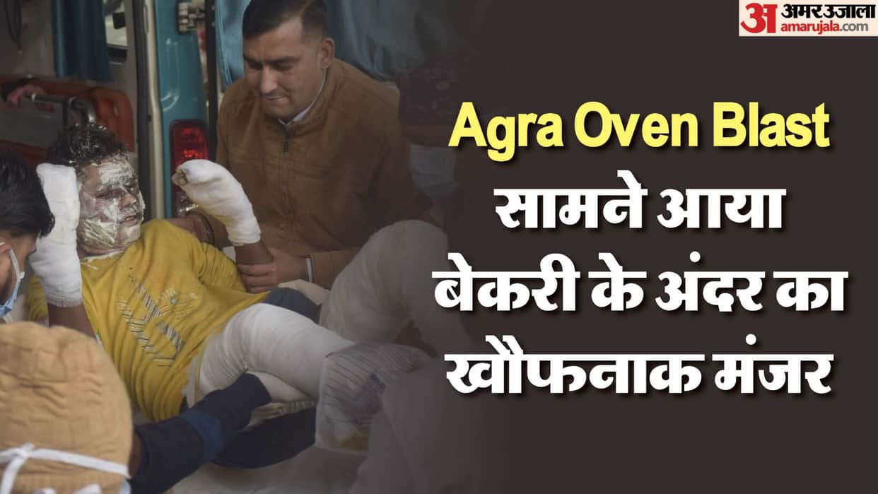 Agra oven explosion Blast while making bread 14 workers burnt five in critical condition