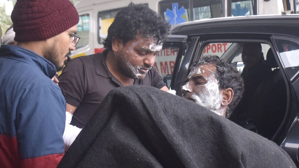 Agra oven explosion Blast while making bread 14 workers burnt five in critical condition