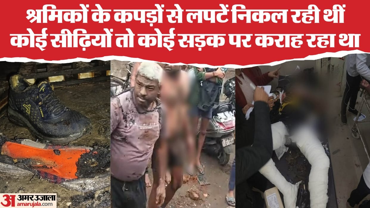 Oven Blast In Agra Krishna had come to give tiffin to his friend also got burnt in fire scene sent shivers