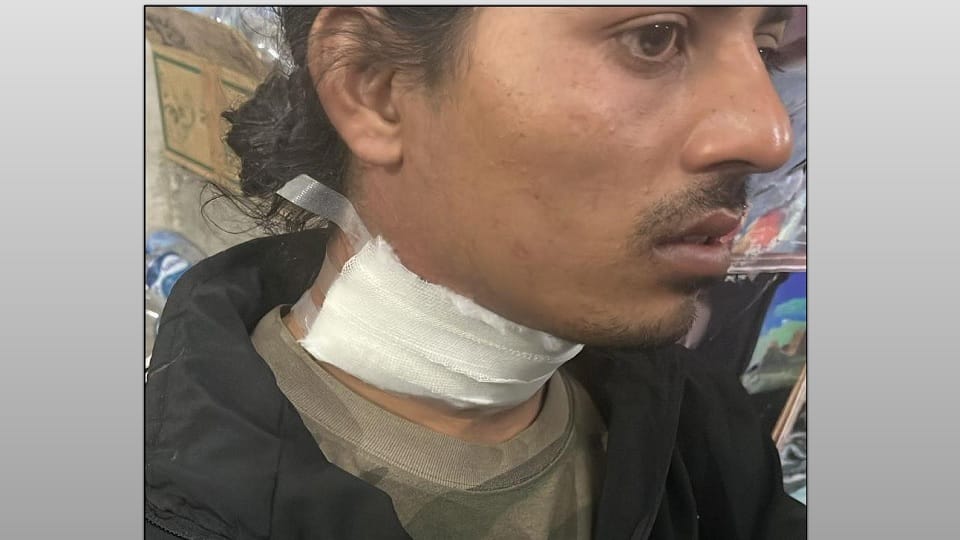 Saharanpur: Gym trainer's neck cut with a Chinese manja, four fingers of his hand were also cut.