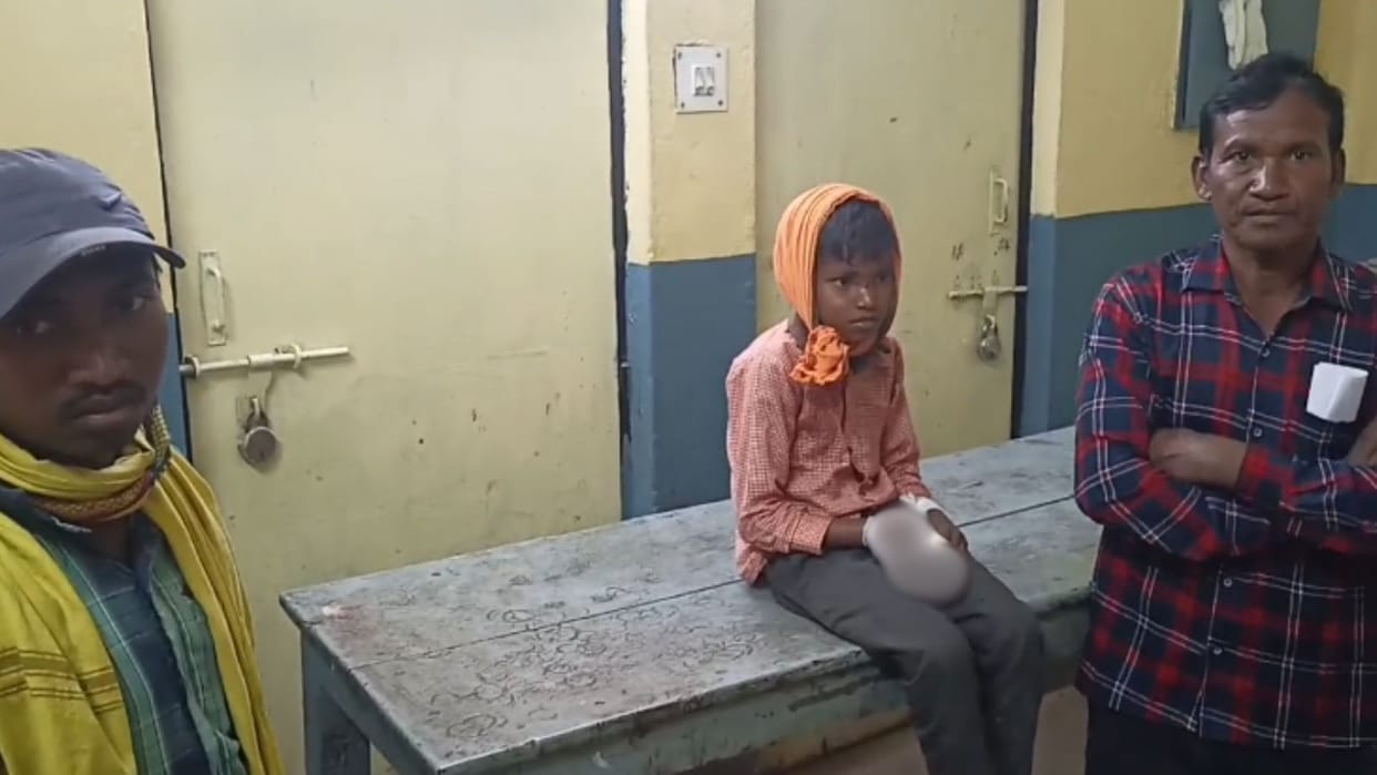 child burnt when battery exploded with loud bang while charging in sonbhadra