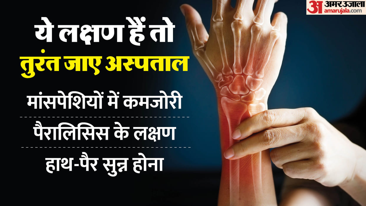 Guillain-Barré Syndrome Detected in Jaipur Three Cases Reported Details in Hindi