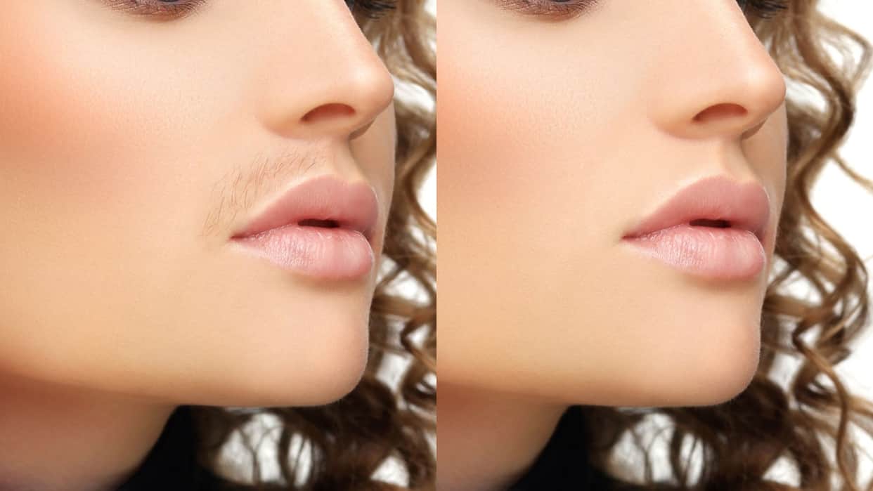 how to remove upper lips hair at home in hindi upper lips ke baal kaise hataye gharelu upay