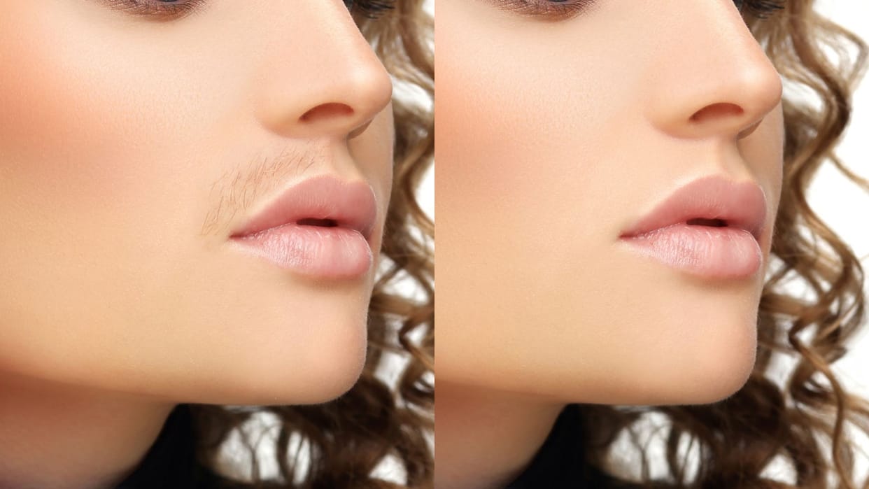 how to remove upper lips hair at home in hindi upper lips ke baal kaise hataye gharelu upay