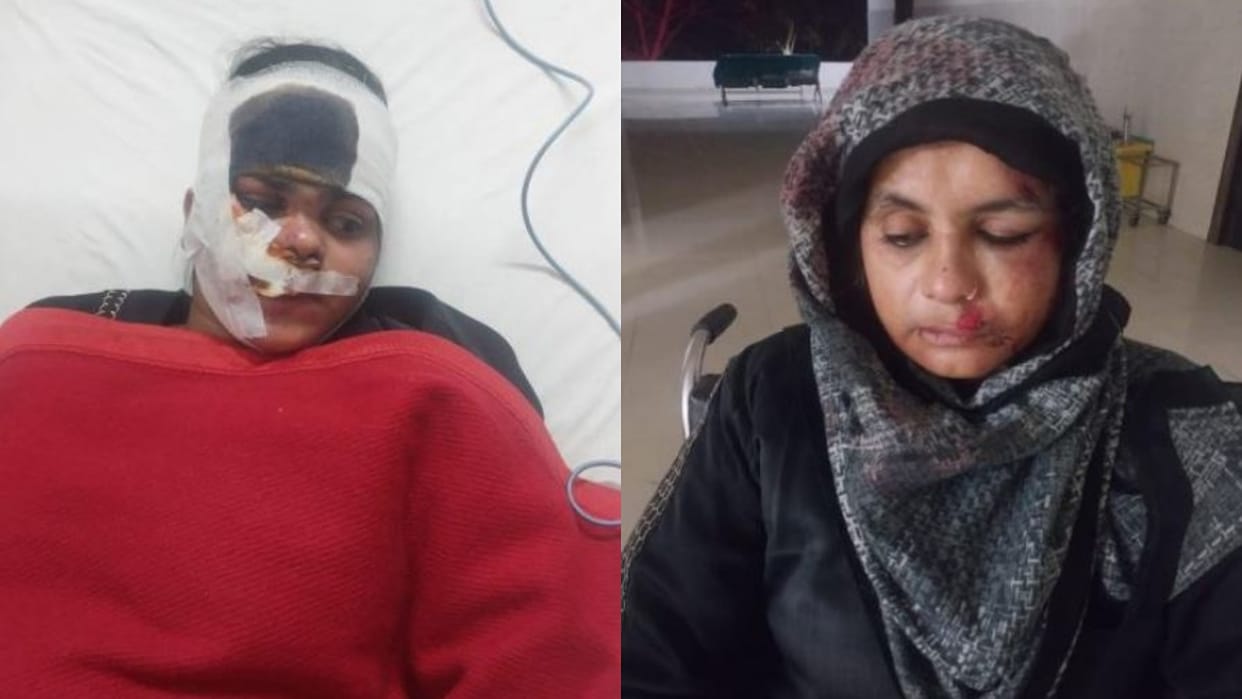 miscreants looted the bag full of jewels from the couple riding the bike in bareilly