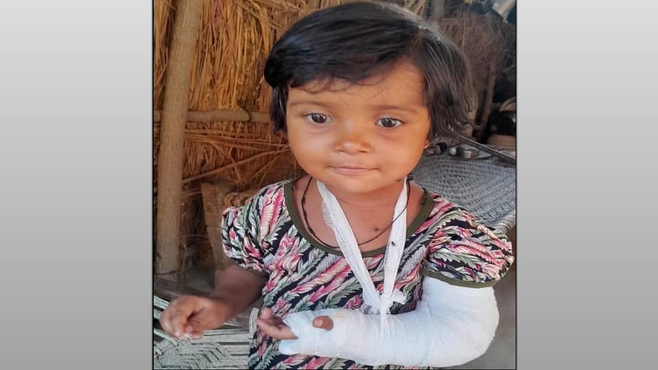 Saharanpur: A pack of dogs pounced on a five-year-old girl playing outside the house, biting her to death.