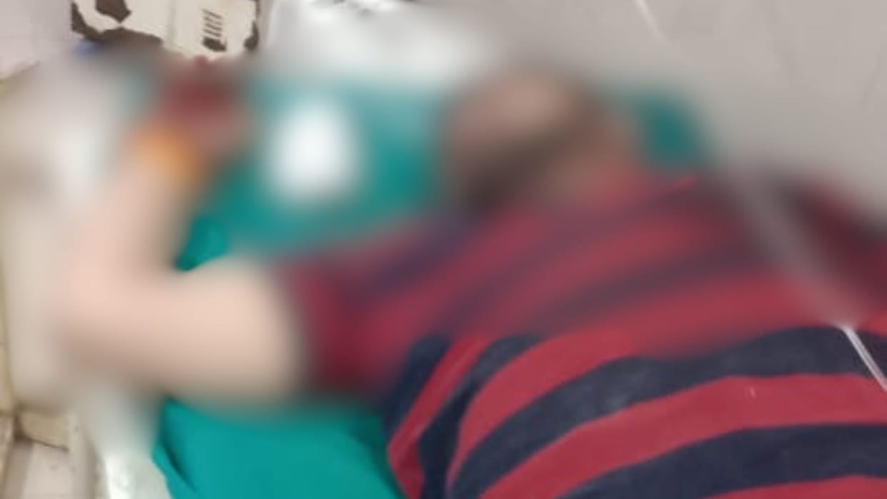 Two parties clashed over vehicle collision two injured in firing incident at Sheetla Mata Chowk late night