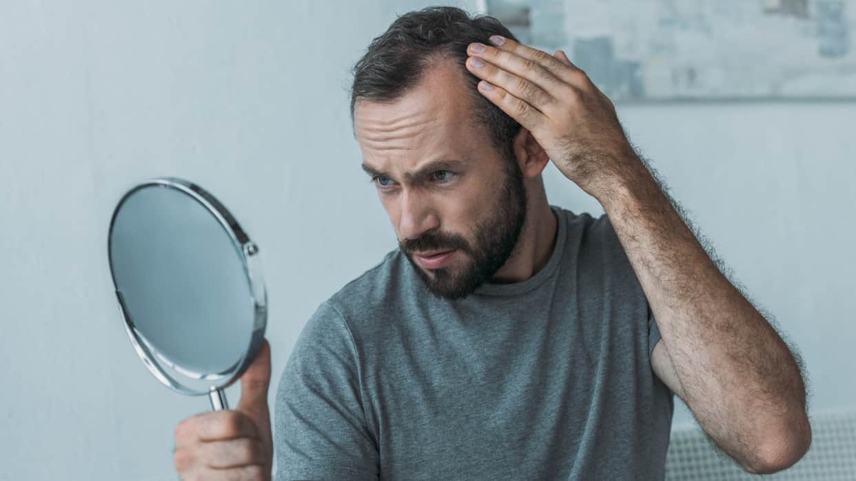 Hair Loss Increasing Reason know what vitamin deficiency causes hair loss and baldness