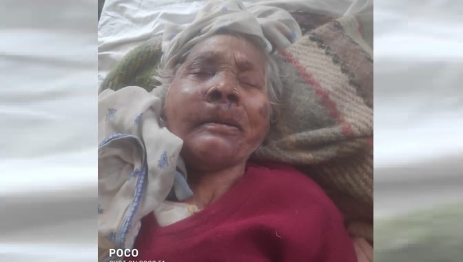 100 year old grandmother punched jaw broken grandson got angry when asked about missing money arrested
